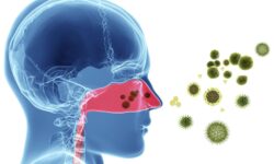 Alergiile sezoniere în contextul pandemiei COVID-19